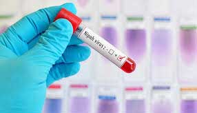 21nipah virus