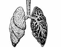 Lung scans for stroke patients can detect Covid early: Study 1 02lungs