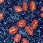 mpox