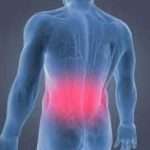 back pain