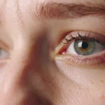 Diabetic retinopathy remains unrecognised till vision loss sets in : Experts 11 Diabetic retinopathy remains unrecognised till vision loss sets in : Experts